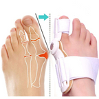 Stop Foot Pain Now™ — Relieve Bunion Agony and Reclaim Pain-Free Steps