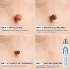 RamiraClear™ — Melt Away Blemishes Pain-Free and Reveal Radiant Skin in Just 7 Days