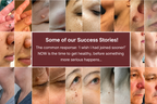 Aurevia™ — Reveal Smooth, Flawless Skin Without Pain or Hassle