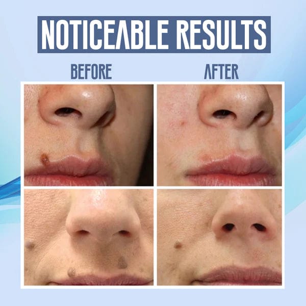 LumiClear™ Skin Pen — Instantly Erase Flaws and Love Your Reflection Again