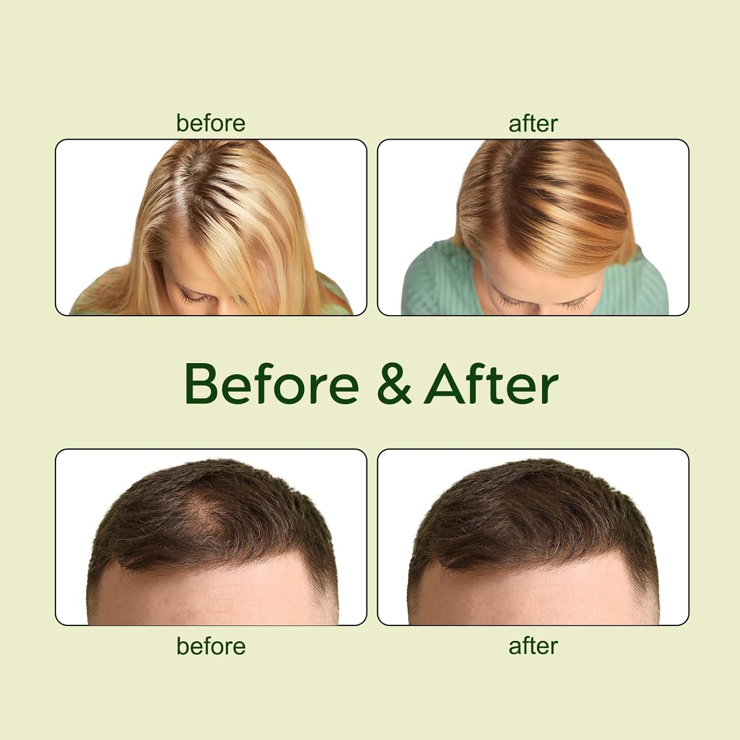 FloraLux™ — Unlock Thick, Silky Hair That Turns Heads Fast (1+1 FREE TODAY!)