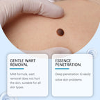 LumaVera™ — Smooth Away Spots with Gentle, Precise Care You Can Trust