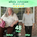 VioraLuxe™ 6-in-1 Nano Microneedle Patch — Melt Fat and Reveal Radiant, Youthful Confidence Fast
