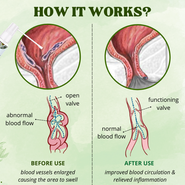 Ramorelle™ Herbal Relief Spray — Fast, Gentle Calm That Lets You Live Pain-Free