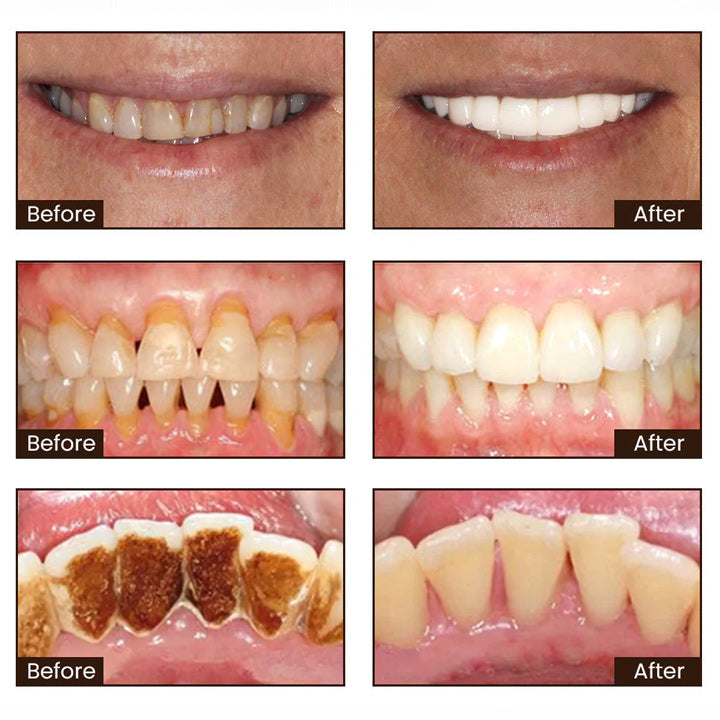 LumoraBeam™ — Unleash a Radiant Smile That Heals and Turns Heads