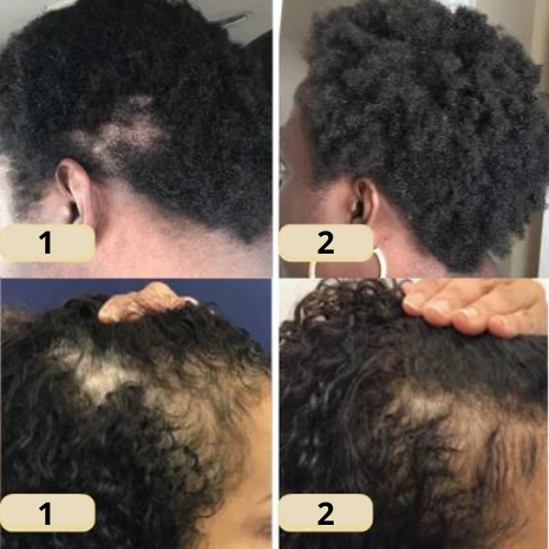 Your natural oil for hair growth (1+1 FREE TODAY!)