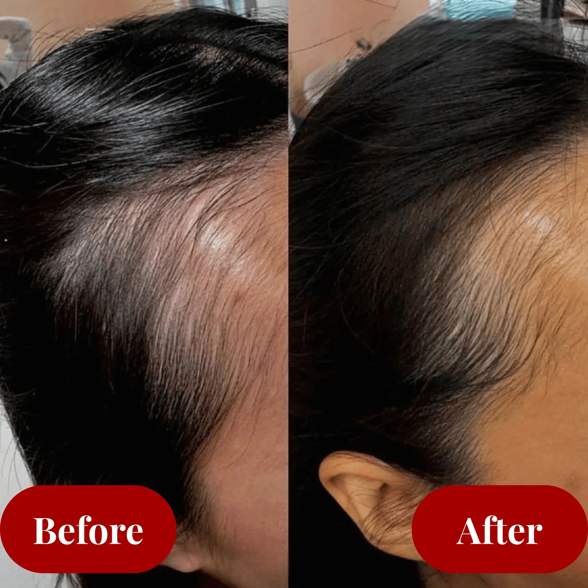 SilkAura™ Hair Elixir — Watch Your Hair Burst Into Life with Unstoppable Thickness