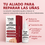 SereniNail™ Antifungal Repair Drops — Reclaim Gorgeous, Strong Nails You’re Proud to Show Off
