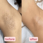SilkGlide™ — Glide into Silky Smooth Skin Without a Second Thought
