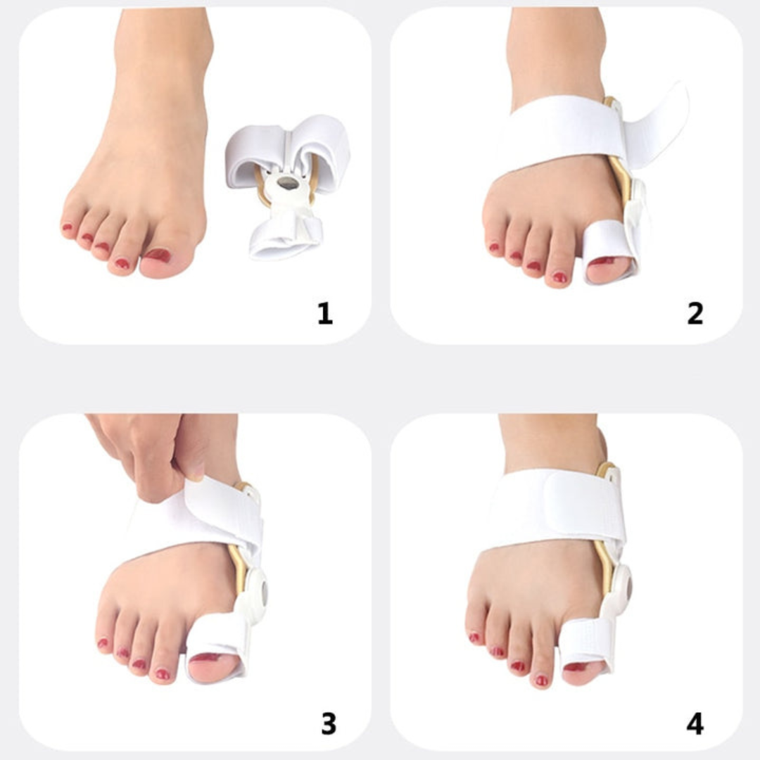 AlignaStep™ — End Bunion Pain and Step Confidently into Comfort
