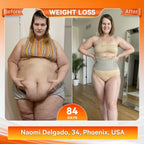 VeloSculpt™ — Ignite Fat-Burning Heat for Effortless Slimming Confidence