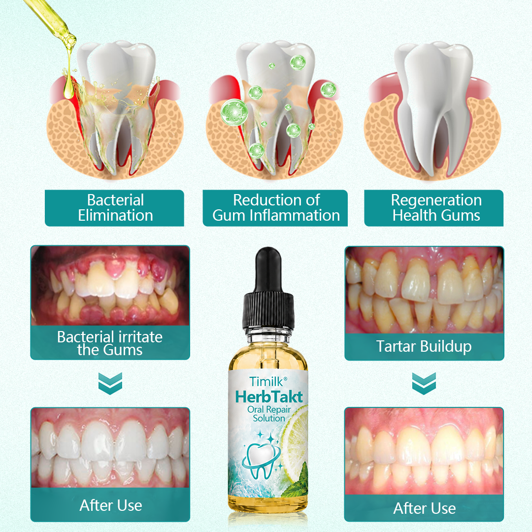 GlaciaMint™ Botanical Oral Repair Drops — Crush Bad Breath and Soothe Gums for Fresh Confidence All Day