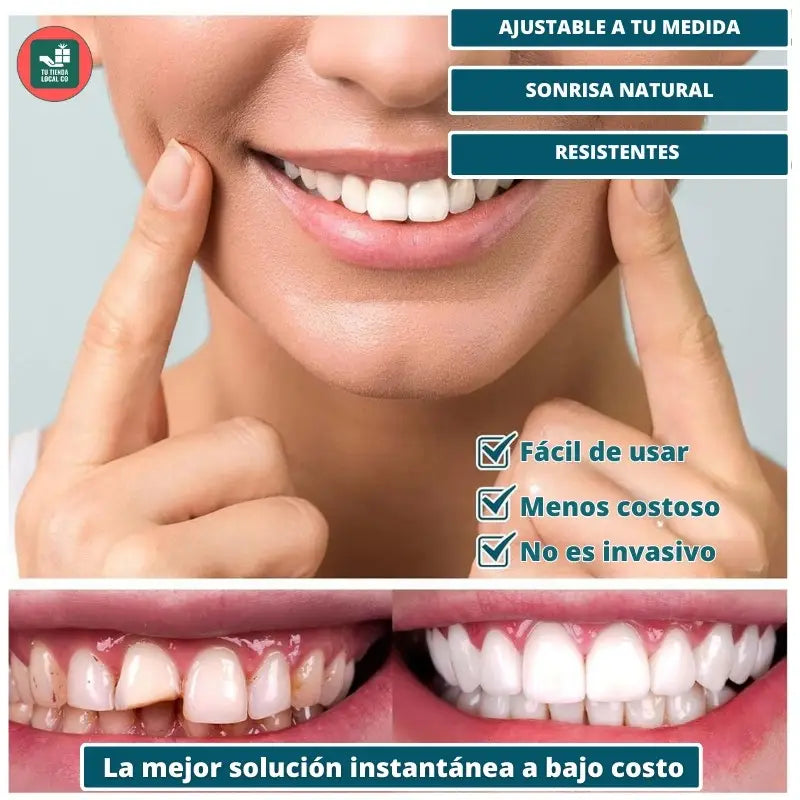 RadiantLift™ Veneers — Instantly Unlock Confidence with a Flawless, Natural-Looking Smile