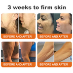 VitaFirm™ — Unleash Rock-Hard, Youthful Skin That Turns Back Time (1+1 FREE TODAY!)