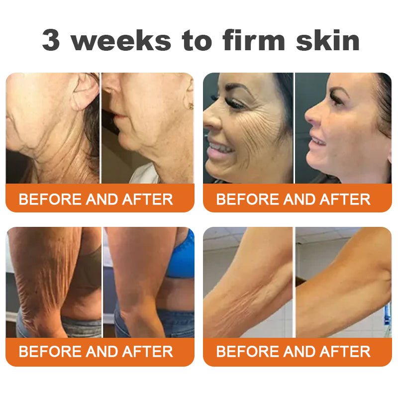 VitaFirm™ — Unleash Rock-Hard, Youthful Skin That Turns Back Time (1+1 FREE TODAY!)