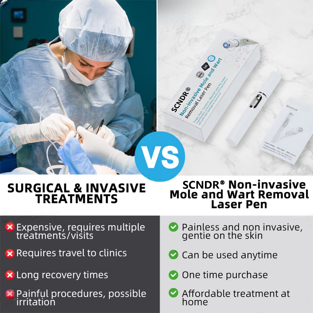 SCNDR® 🏅Non-Invasive Mole and Wart Removal Laser Pen