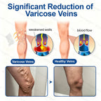 Veneliss™ Patch — Wake Up to Pain-Free, Beautiful Legs That Move You