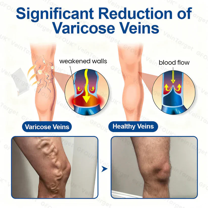 Veneliss™ Patch — Wake Up to Pain-Free, Beautiful Legs That Move You