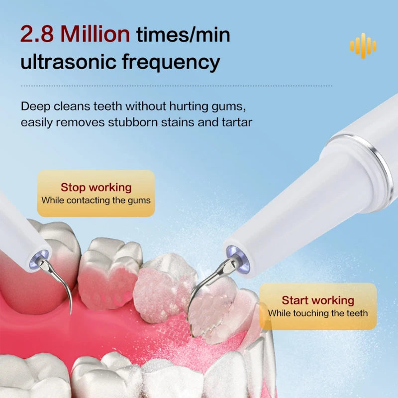 AuraShine™ Ultrasonic Scaler — Unleash a Radiant Smile That Demands Attention