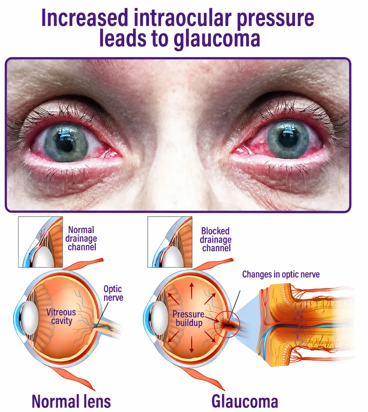 VisionRise™ — Awaken Youthful, Vibrant Vision Without Surgery or Drops