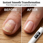 GlowEdge™ — Effortless Salon-Perfect Nails That Boost Your Confidence Instantly