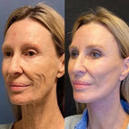 LumaVive™ — Instantly Reboot Your Skin’s Youthful Glow and Confidence (1+1 FREE TODAY!)