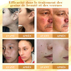 LuminaVex™ — Melt Away Skin Bumps and Unleash Your Natural Glow