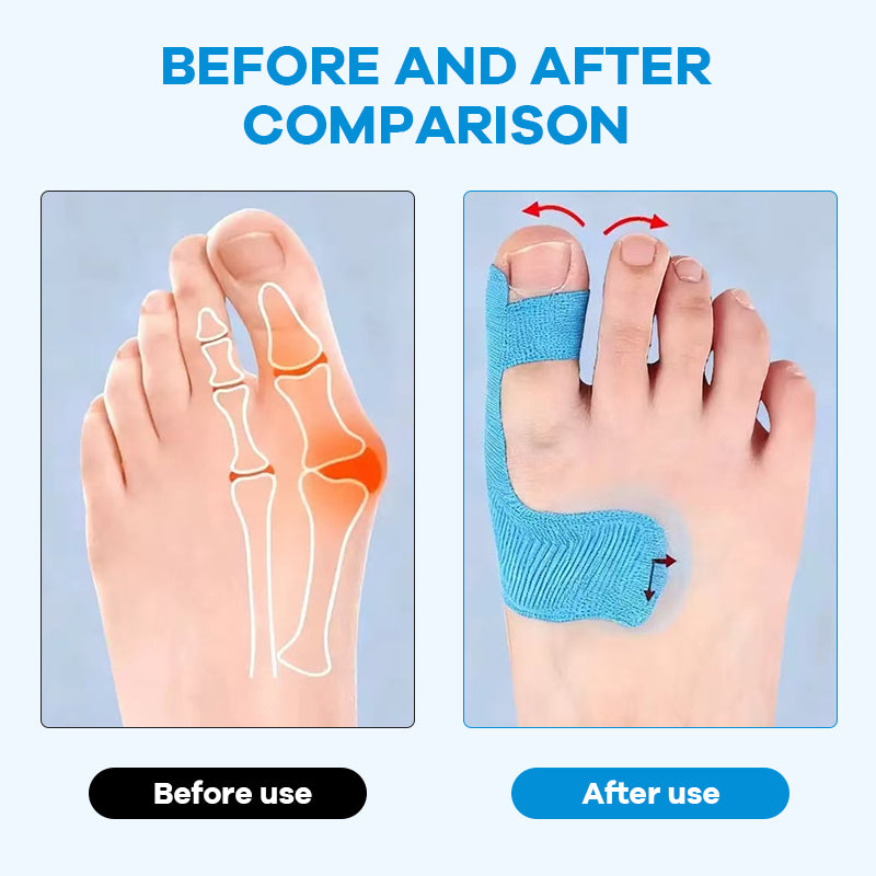 SolaceStep™ — Walk Pain-Free with Invisible, All-Day Bunion Relief