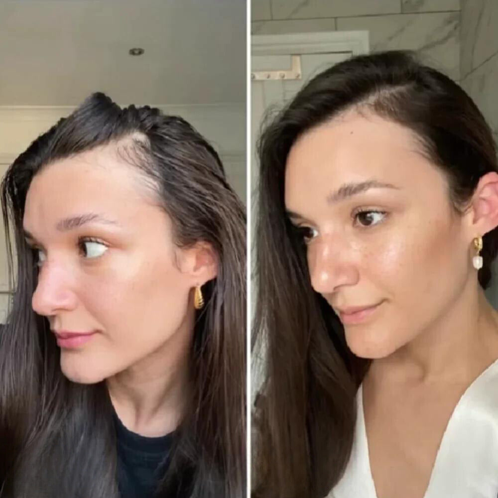 Your natural oil for hair growth (1+1 FREE TODAY!)