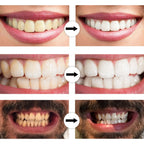 LumoBright™ — Unlock a Radiant Smile That Turns Heads Instantly