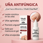 SereniNail™ Antifungal Repair Drops — Reclaim Gorgeous, Strong Nails You’re Proud to Show Off