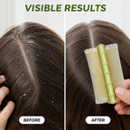 SilkaBreeze™ — End Itch & Tangles for Smooth, Happy Scalp Freedom