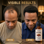 LuxeStrand™ Hair Revival Therapy — Ignite Your Confidence with Thicker, Stronger Hair Every Day