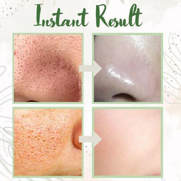 Green Tea Deep Cleanse Mask (1+1 FREE TODAY!)