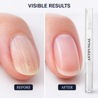 VividNail™ — Transform Your Nails into Strong, Radiant Confidence Boosters