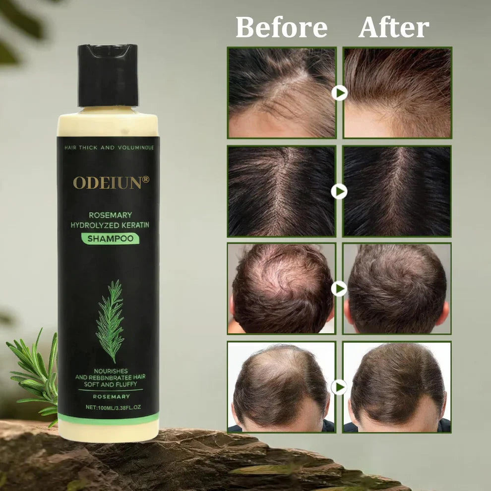 RamoraRoot™ — Unlock Thick, Lush Hair That Feels Alive and Strong Every Day