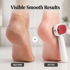 VelaraSilk™ — Effortless Softness That Makes Your Feet Impossible to Ignore