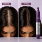 ScalpaRise™ — Wake Up Your Scalp and Reclaim Thick, Confident Hair Every Day