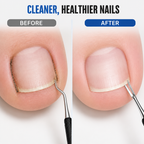 SilkStride™ — Unlock Confidence with Salon-Perfect, Spotless Toenails Every Time