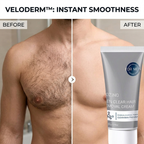 VeloDerm™ Hair Removal Cream — Zap Thick Hair Instantly for Baby-Soft, Irritation-Free Skin
