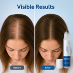 ManeBloom™ — Feel More Like Yourself with Fuller-Looking Hair