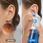 AuraClear™ Ear Care System — Experience the Bliss of Clean, Clear, and Comfortable Ears Every Day