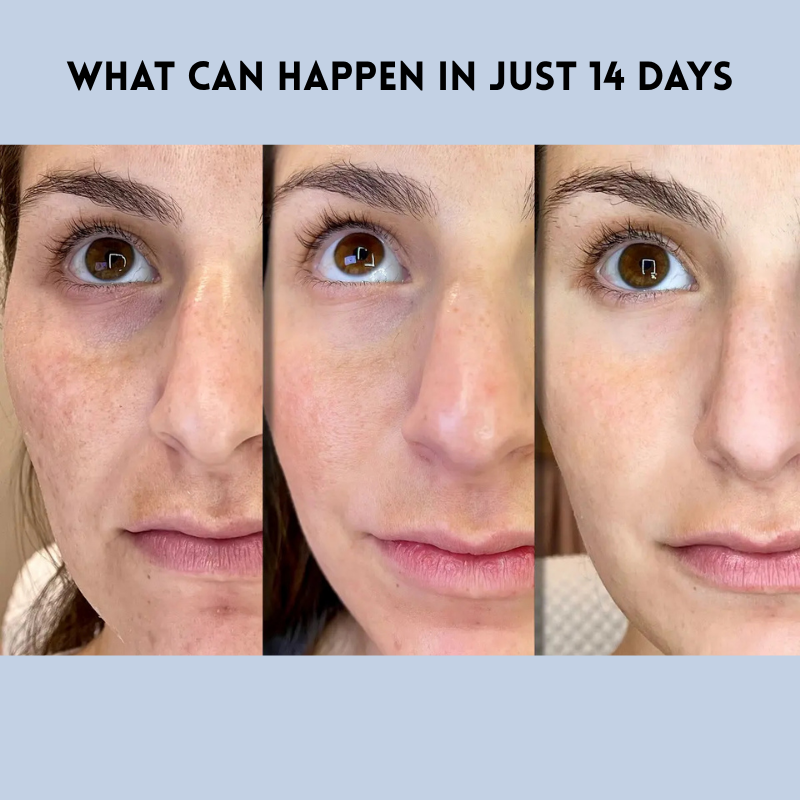 LiftEssence™ Skin Strips — Instantly Lift and Glow Like You’ve Turned Back Time