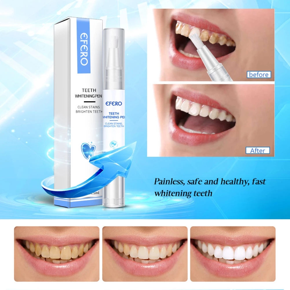 LumaShine™ — Dazzle Instantly with a Pain-Free, Confidence-Boosting Smile (1+1 FREE TODAY!)