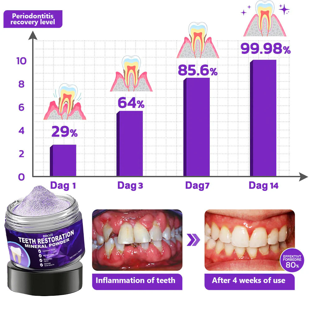 LuxSmile™ Teeth Renewal Mineral Powder — Transform Your Smile with Radiant, Pain-Free Confidence Every Day