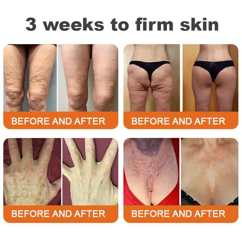 VitaFirm™ — Unleash Rock-Hard, Youthful Skin That Turns Back Time (1+1 FREE TODAY!)