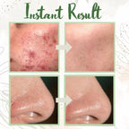 Green Tea Deep Cleanse Mask (1+1 FREE TODAY!)