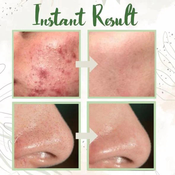 Green Tea Deep Cleanse Mask (1+1 FREE TODAY!)