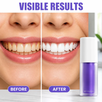 LumiShade™ Radiance Paste — Ditch Yellow Stains and Smile Like You Mean It