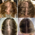Your natural oil for hair growth (1+1 FREE TODAY!)